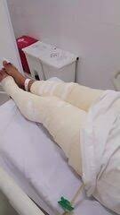 Homem é suspeito de tentar matar irmão queimado enquanto ele dormia no Ceará